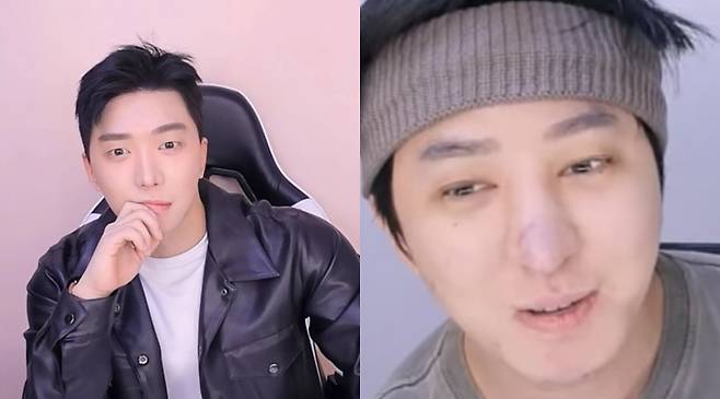 ▲ 강학두 성형 전(왼쪽), 후. 출처| 강학두 방송 캡처