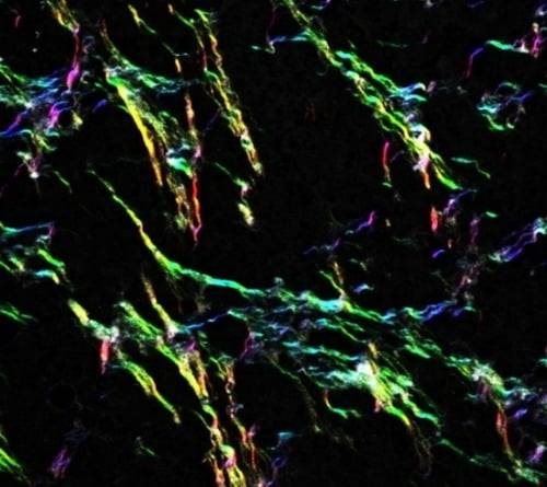 암 종양에 퍼진 콜라겐 섬유를 다광자 현미경으로 촬영한 모습. /사진=연합뉴스