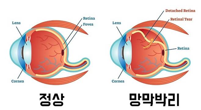 출처: 게티 이미지뱅크