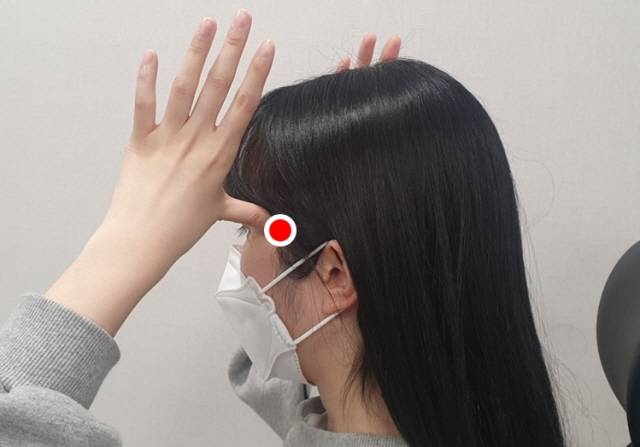태양혈/사진=자생한방병원 제공