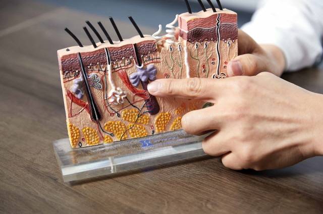 서울대 피부과 서대헌 교수가 여드름 원인을 설명하며, 모형 속 여드름 염증(보라색)을 가리키고 있다./사진=신지호 헬스조선 기자