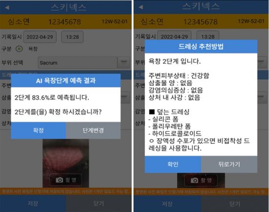 삼성서울병원과 파인헬스케어가 공동개발한 AI 욕창 단계 예측 솔루션 시스템 스키넥스.