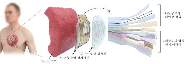 심장 부착형 패치형 디바이스 플랫폼 설계 모식도 [기초과학연구원(IBS) 제공. 재판매 및 DB 금지]