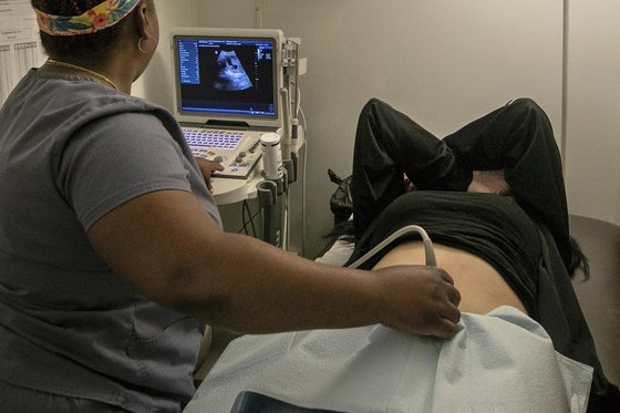 2022년 7월 6일 미국 LA의 한 낙태 클리닉에서 임신부가 초음파 검사를 받고 있다. AP=연합뉴스