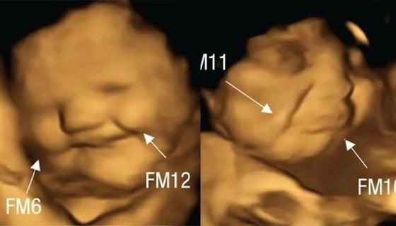 당근을 섭취한 임신부 집단의 태아들에게선 올라간 입꼬리(왼쪽), 케일을 섭취한 집단의 태아들에게선 내려간 입꼬리가 관찰됐다. /사진=세이지저널