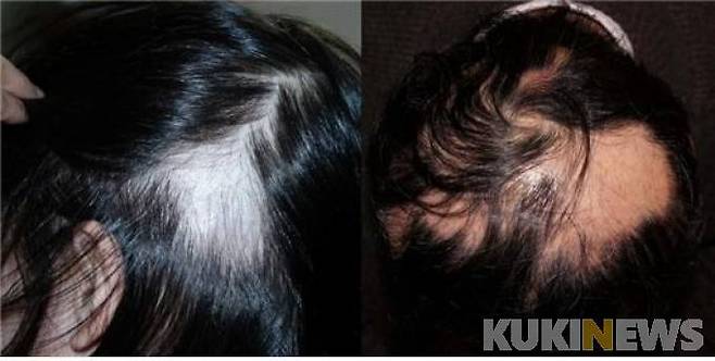 기사내용과 무관. 사진=쿠키뉴스 DB