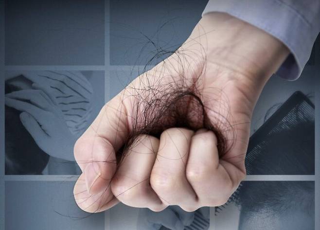 일본 연구진이 인공 모낭과 머리카락 배양에 성공, 탈모 치료의 새로운 희망이 생겼다. [사진=클립아트코리아]