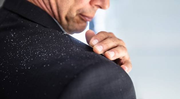 비듬의 원인은 세균 과다 증식인데 피부 타입에 따라 완화법도 다르다./사진=클립아트코리아