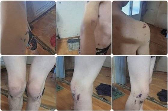 집단 감금·폭행 사건의 피해자는 18일 동안 동갑내기 친구들에게 린치를 당했다. 전치 6주 상해진단을 받았으나 경찰은 고소장을 반려하는 등 초기 대응에 미온적이었다. / 사진:이세욱