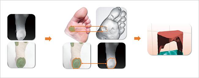 로킷헬스케어의 AI 병변 분석 시스템. 스마트폰으로 촬영한 사진을 기반으로 3D 모델을 만들어 병변의 넓이와 깊이 등을 분석한다. 사진 로킷헬스케어
