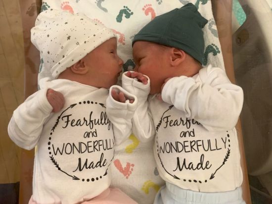 30년간 냉동보관된 배아에서 태어난 쌍둥이. 사진=EPA연합뉴스