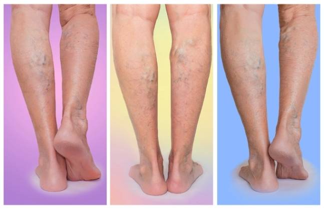 게티이미지뱅크