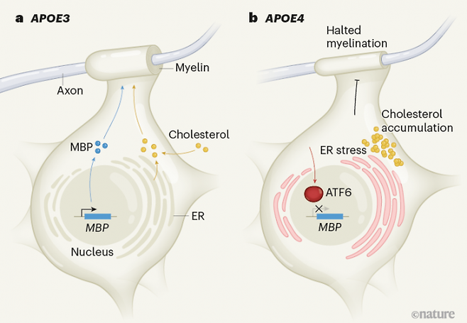 APOE4 변이형 단백질이 알츠하이머병 위험성을 높이는 메커니즘이 최근 밝혀졌다. 뇌의 희소돌기아교세포가 뉴런 축삭(axon)의 미엘린을 만드는 과정에서 APOE3 변이형은 콜레스테롤을 원활히 공급한다(왼쪽). 그런데 APOE4 변이형은 대신 세포 안에 콜레스테롤이 쌓여 미엘린이 부실해져 뉴런이 쉽게 손상된다(오른쪽). 네이처 제공