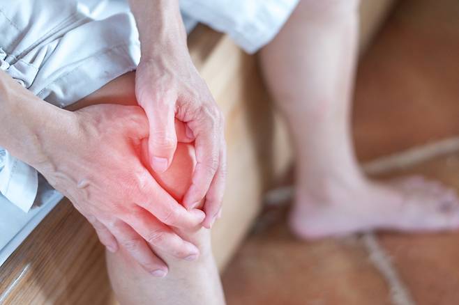 통풍. 게티이미지뱅크