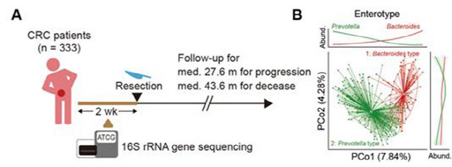 A. 333명의 대장암 환자 수술 전 분변에 대한 16S rRNA 유전자 시퀀싱과 추적 관찰. 

B. 장내 미생물 군집의 표현형. 박테로이데스와 프리보텔라 타입으로 구분됨.