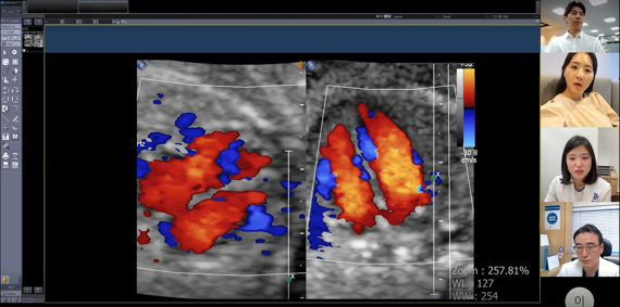 보호자와 산모, 2차 의료기관(미즈메디병원 전진동 진료부장), 세브란스병원(권하얀 산부인과 교수) 주치의가 산모의 초음파 검사 결과를 함께 보며 협진을 하는 모습. 세브란스병원 제공.