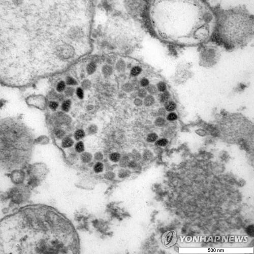 오미크론 변이 현미경 사진 [타스 연합뉴스 자료사진. 재판매 및 DB 금지]