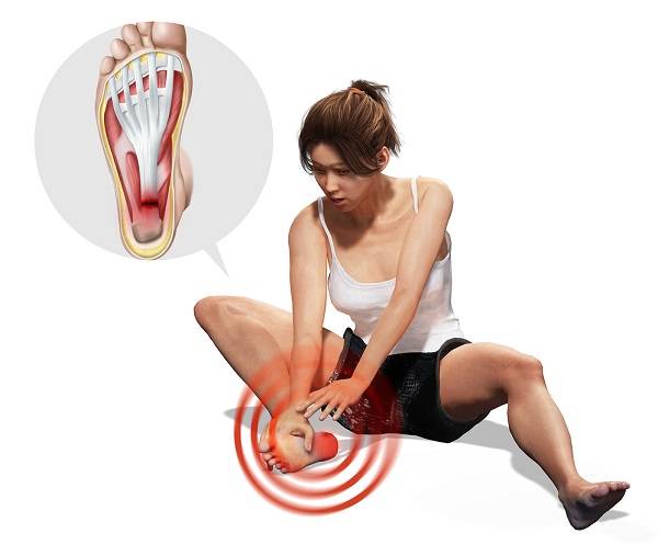 족저근막 통증ㅣ출처: 클립아트코리아