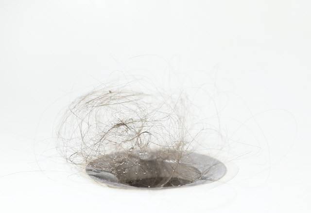 중국에서 코로나 확진자들이 심각한 탈모 증세를 호소했다. 이는 스트레스, 고열 등에 의한 일시적 현상이다./사진=게티이미지뱅크