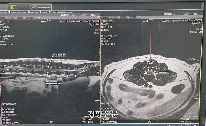 로이는 MRI 촬영 결과 요추 4·5번 사이의 디스크가 파열된 것으로 확인됐다. 전현진 기자