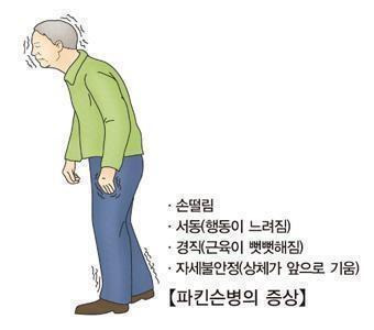 파킨슨병의 증상. 출처: 서울아산병원