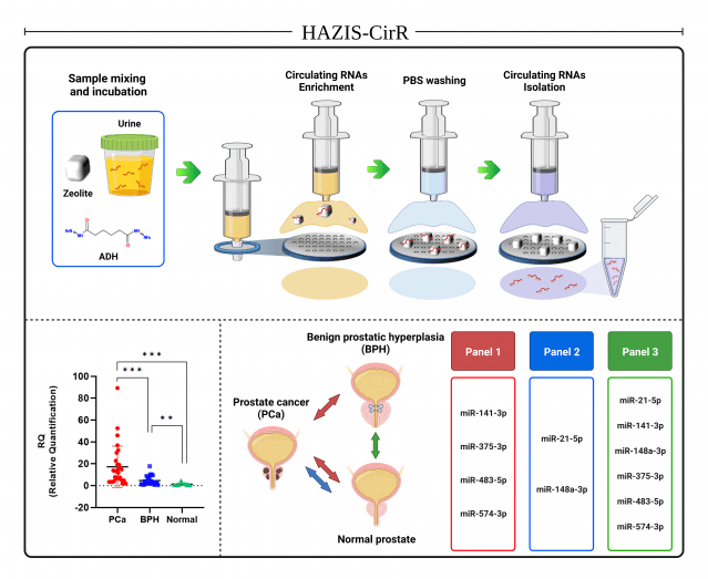 소변 유래 순환 RNA를 이용한 전립선암 진단 기술 (자료=연세대)