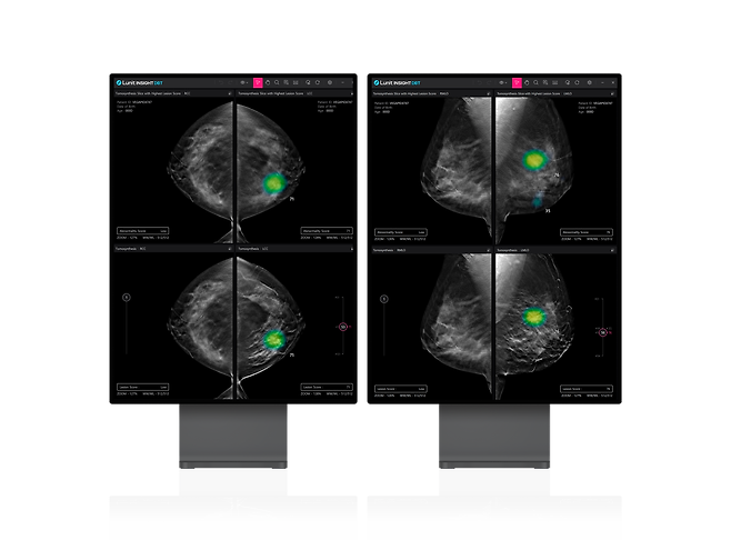 루닛의 3차원(3D) 유방단층촬영술(DBT) 인공지능(AI) 영상분석 솔루션 ‘루닛 인사이트 DBT’. /루닛
