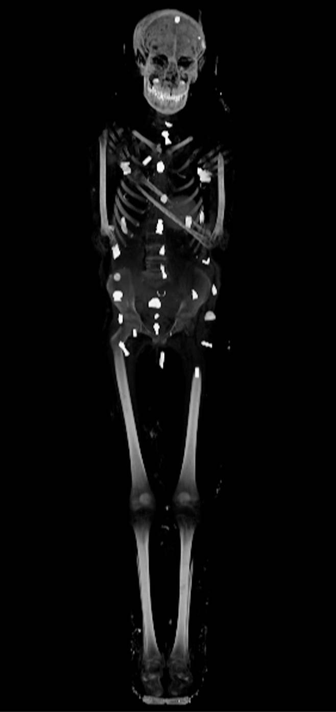약 2300년 전의 것으로 추정되는 이집트 소년의 미라를 컴퓨터 단층 촬영(CT)한 사진. 몸 곳곳에 부적이 장식되어 있다./EPA연합뉴스