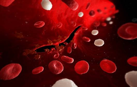 염증은 일종의 신체 면역 반응이다ㅣ출처: 클립아트코리아