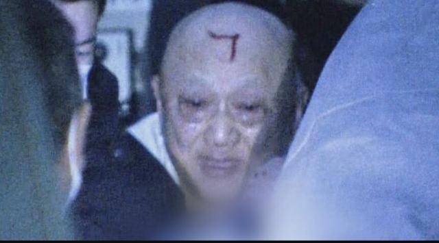 강간미수 혐의로 지난 2월 7일 도쿄 히가시야마토시의 자택에서 체포될 당시의 시부야 히로히토. 경찰에 강하게 저항하다 이마에 상처가 난 것으로 보인다. TBS 방송화면 캡처