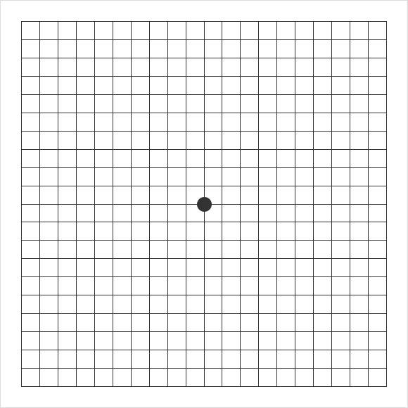 암슬러 격자ㅣ출처: 비앤빛강남밝은세상안과
