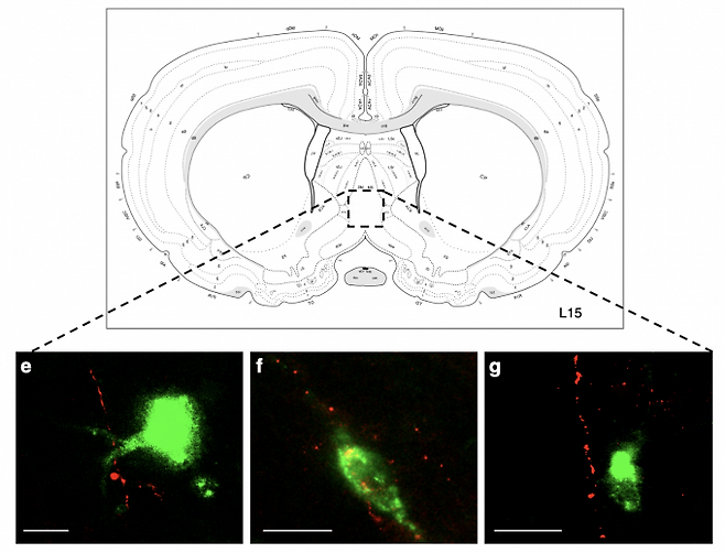 Gut에서 유래한 vagus nerve에 연결된 것으로 밝혀진 내측중격 (medial septum)