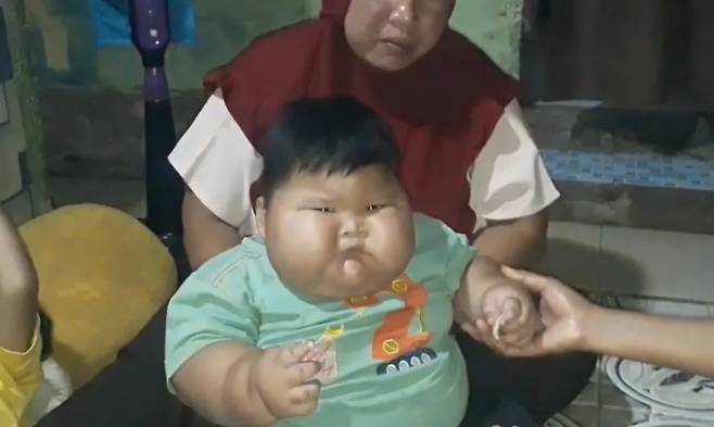 또래 3배 크기…‘아빠 옷’ 입는 인니 16개월 아기의 사연