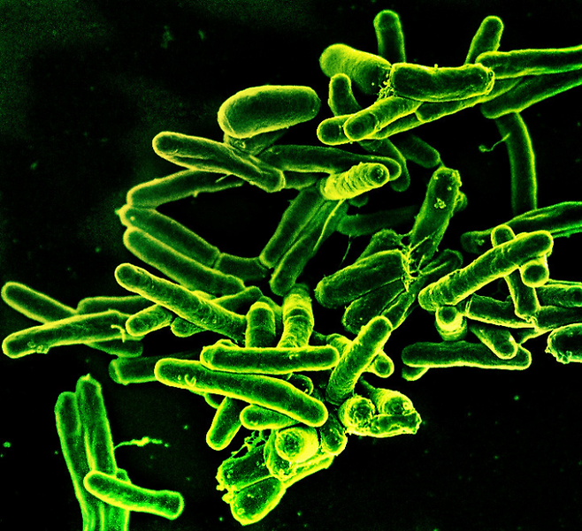 결핵을 유발하는 MYCOBACTERIUM TUBERCULOSIS 박테리아의 주사 전자 현미경 사진 국립알레르기전염병연구소(NIAID) 제공