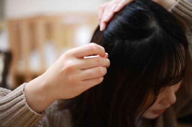 나이가 어린데도 생기는 새치는 유전적, 스트레스 요인뿐 아니라 특정 질환이 원인일 수 있다./사진=게티이미지뱅크