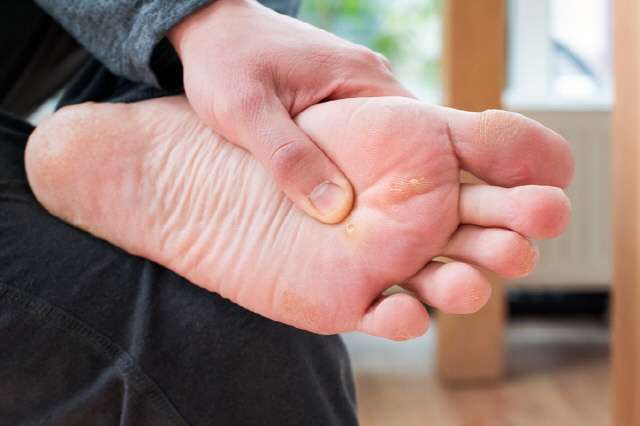 발이 붓거나, 차갑거나, 후끈거린다면 건강에 이상이 있다는 신호일 수 있다./사진=게티이미지뱅크