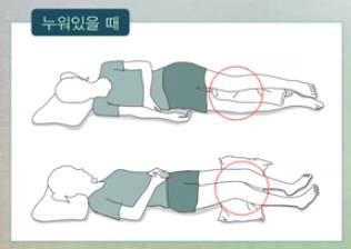 가장 바람직한 수면 자세는 얼굴이 천장을 향하도록 바르게 눕는 것이다. 바로 눕거나 통증 때문에 옆으로 누웠을 땐 바닥과 몸 사이에 빈 공간에 수건을 말아 넣어 근골격계 부담을 줄여주거나 다리 사이에 쿠션을 끼어 골반 비틀림을 방지한다. [자료=삼성서울병원]