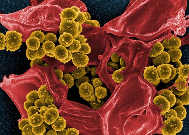 항생제 내성 황색포도상구균의 전자현미경 사진. 노란핵이 세균이고 붉은색은 죽은 백혈구이다./NIH