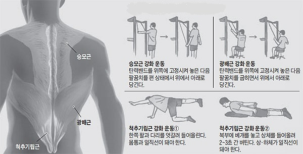 헬스조선DB