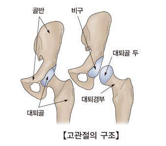 대퇴골 구조 [출처: 서울아산병원]
