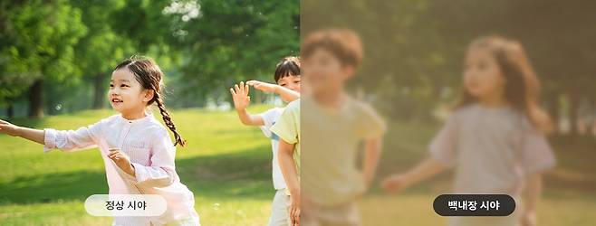 출처:비앤빛강남밝은세상안과