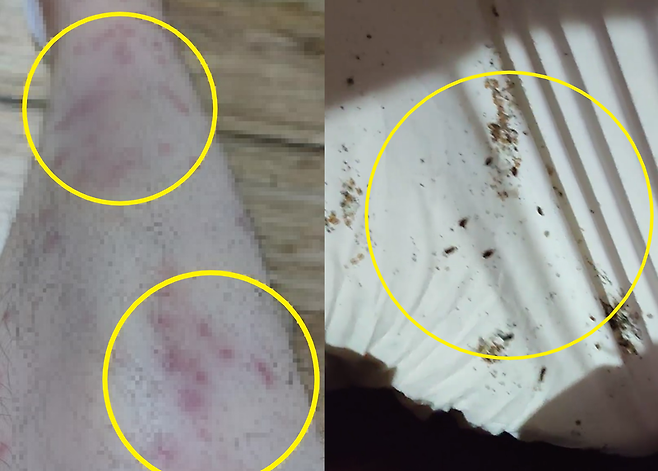 글쓴이가 빈대에 물린 자국이라며 공개한 사진, 모텔 침대에 빈대로 추정되는 벌레가 기어다니고 있는 모습. / 사진 = 온라인 커뮤니티