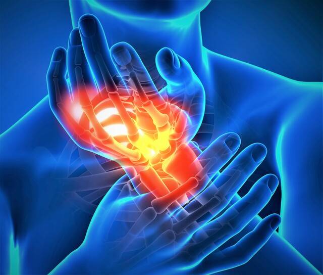 손목건초염은 통증과 부종이 대표적인 증상으로 나타나는 염증성 질환이다. 이미지투데이