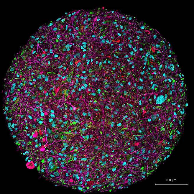 12주 동안 배양한 뇌 오가노이드. 분홍색으로 나타난 물질은 뉴런, 파란색은 세포의 핵이다. 출처: 미국 존스홉킨스대