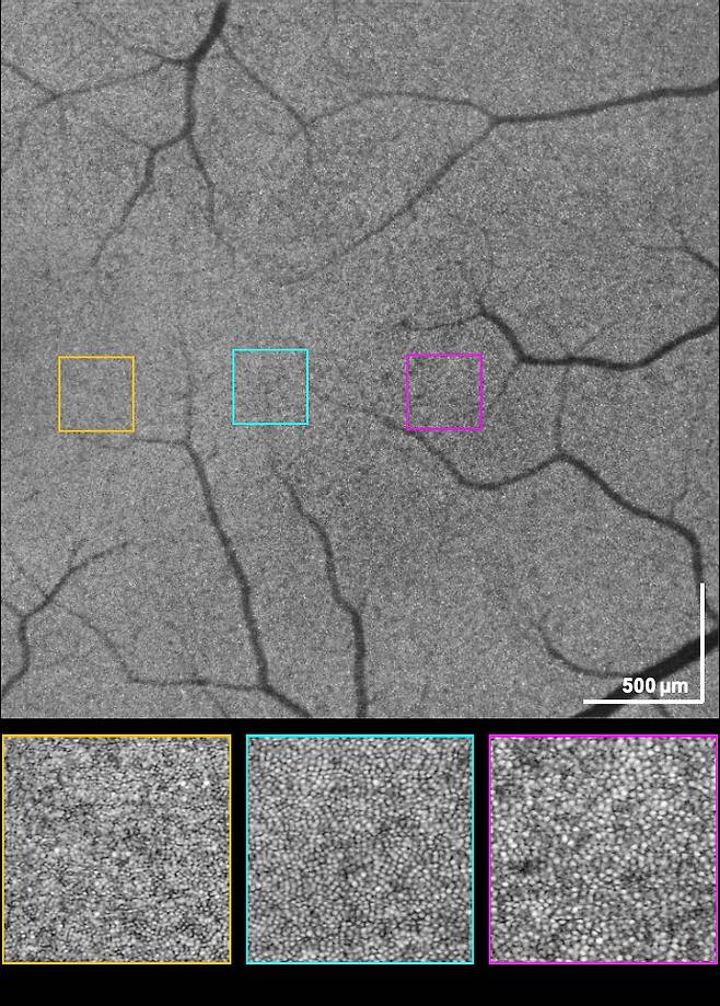 초고속 위상안정 망막 OCT 시스템으로 획득하고, 전산적 수차 및 디포커싱 보정을 통해 얻어진 세포수준 고해상도 영상. 사진=KAIST