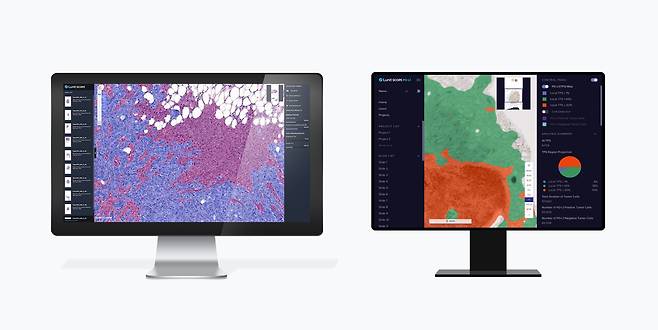 루닛 AI 바이오마커 플랫폼 '루닛 스코프 IO'(왼쪽)와 AI 병리분석 솔루션 '루닛 스코프 PD-L1'(오른쪽)/루닛 제공