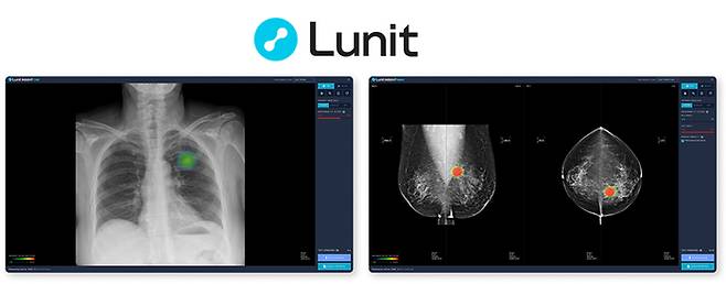 루닛 의료AI 솔루션