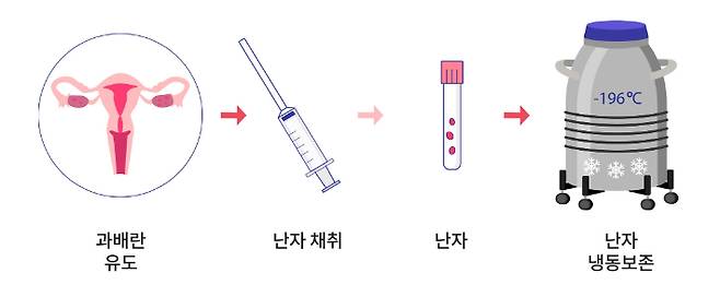 냉동난자 시술 절차. 자료사진