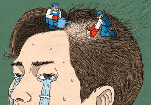 탈모 일러스트.