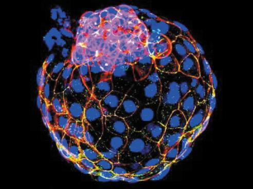 미국 텍사스대 연구진이 만든 배반포 유사체(blastoid). 인간 배아 줄기세포로 만들었다. /미국 텍사스대